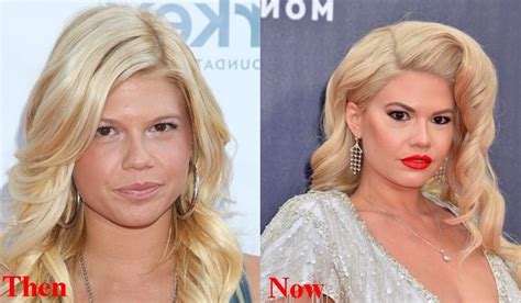 chanel west coast then and now|chanel west coast face change.